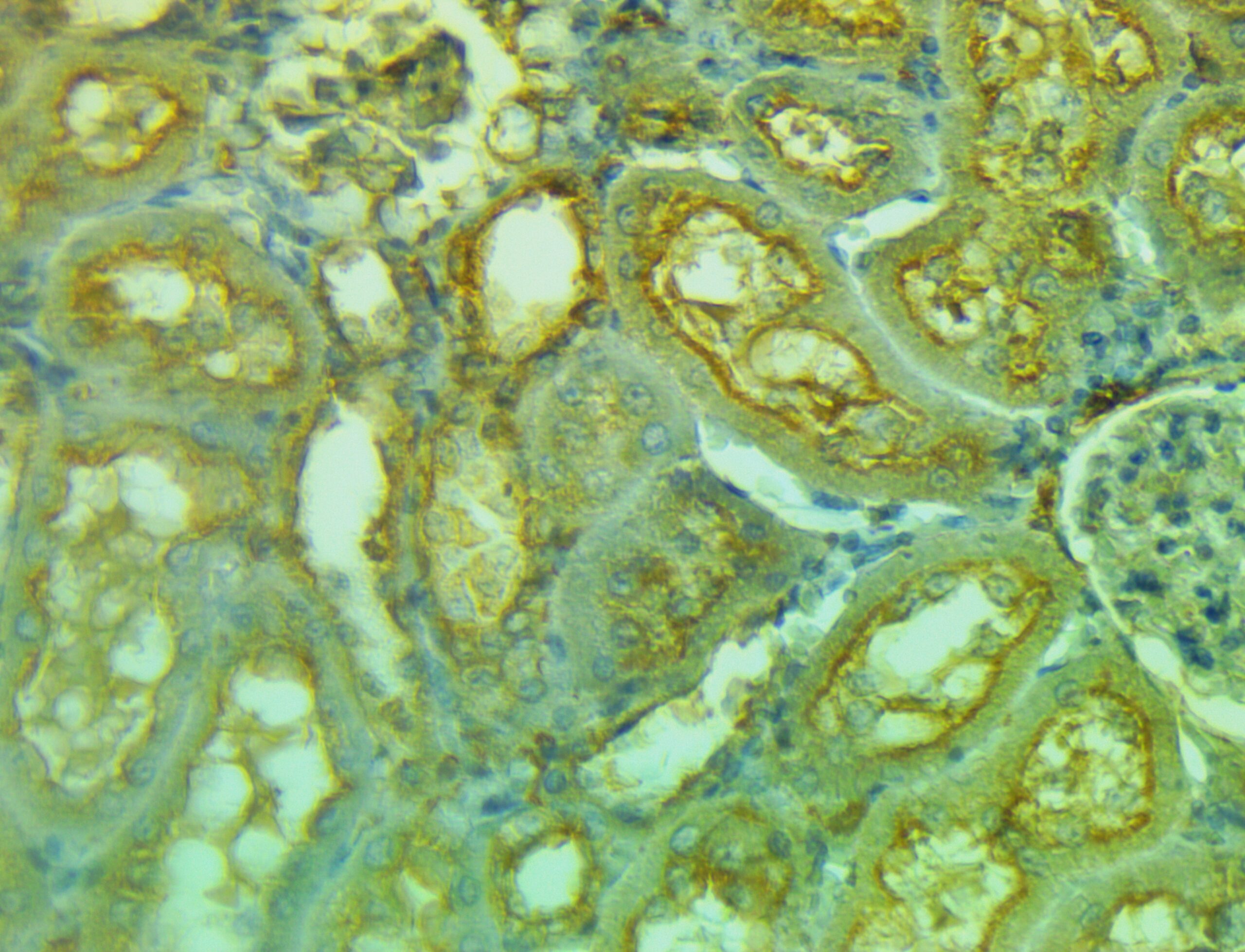 ایمونوهیستوشیمی