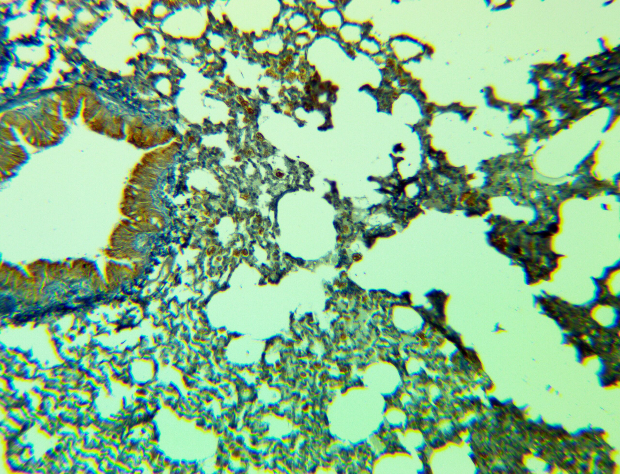 ایمونوهیستوشیمی