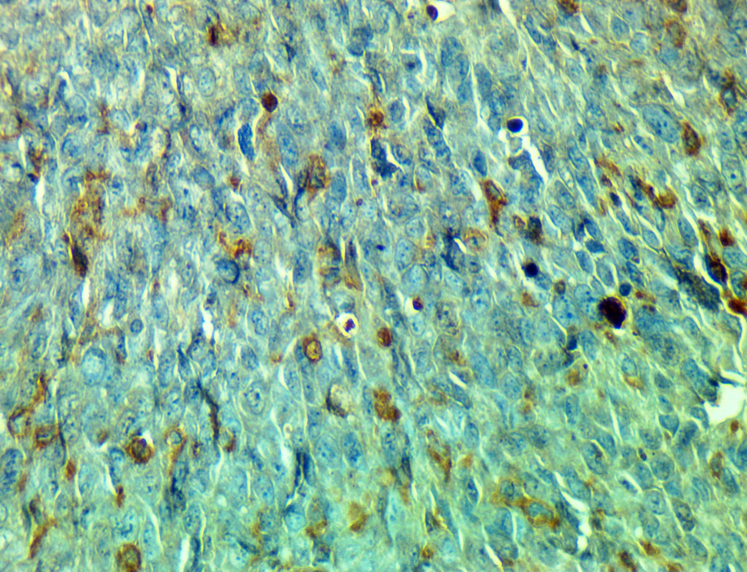 ایمونوهیستوشیمی