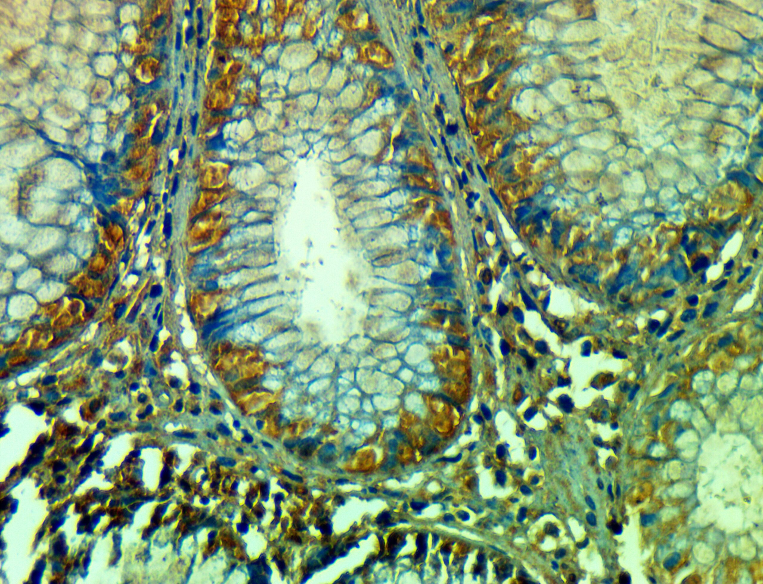 ایمونوهیستوشیمی