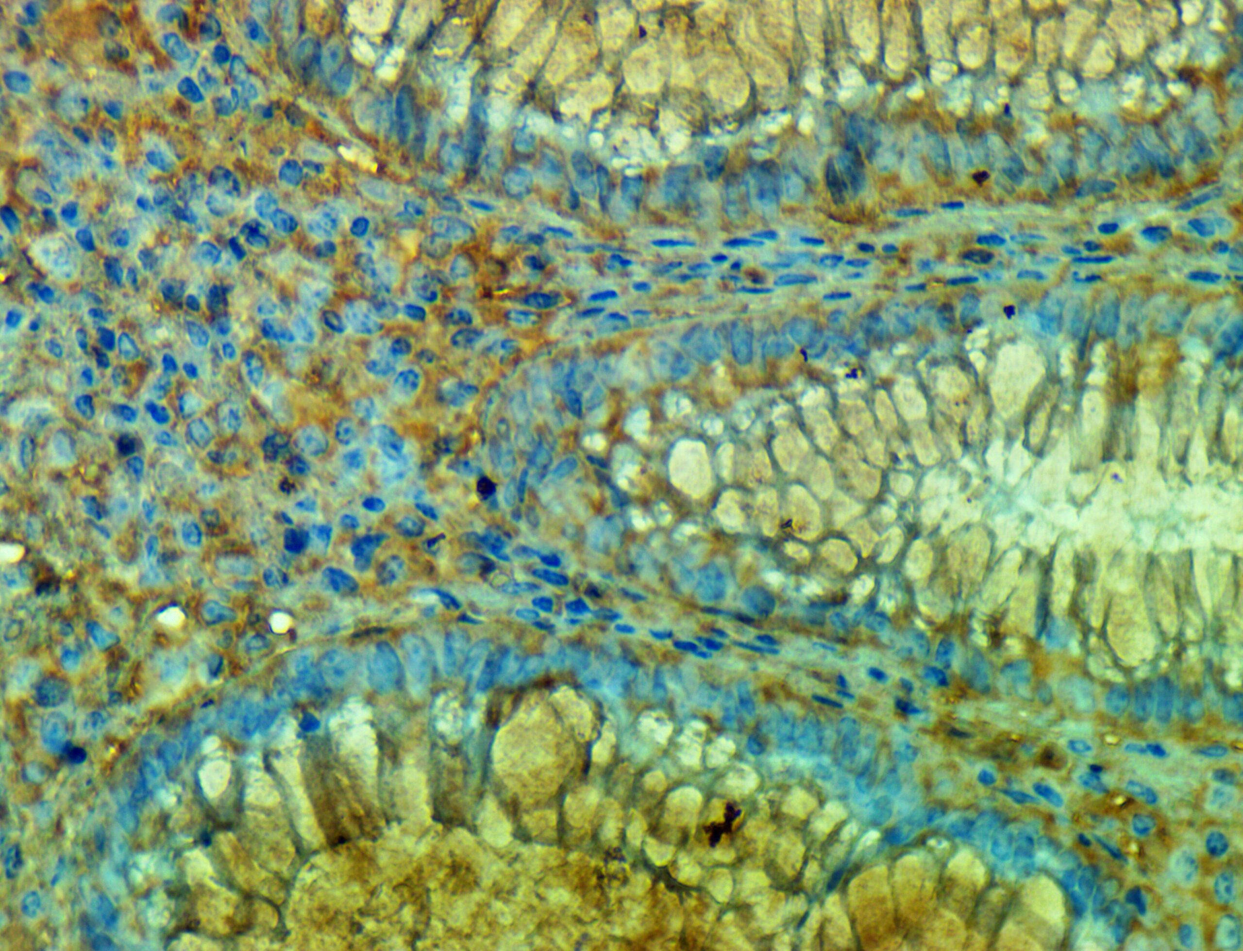 ایمونوهیستوشیمی