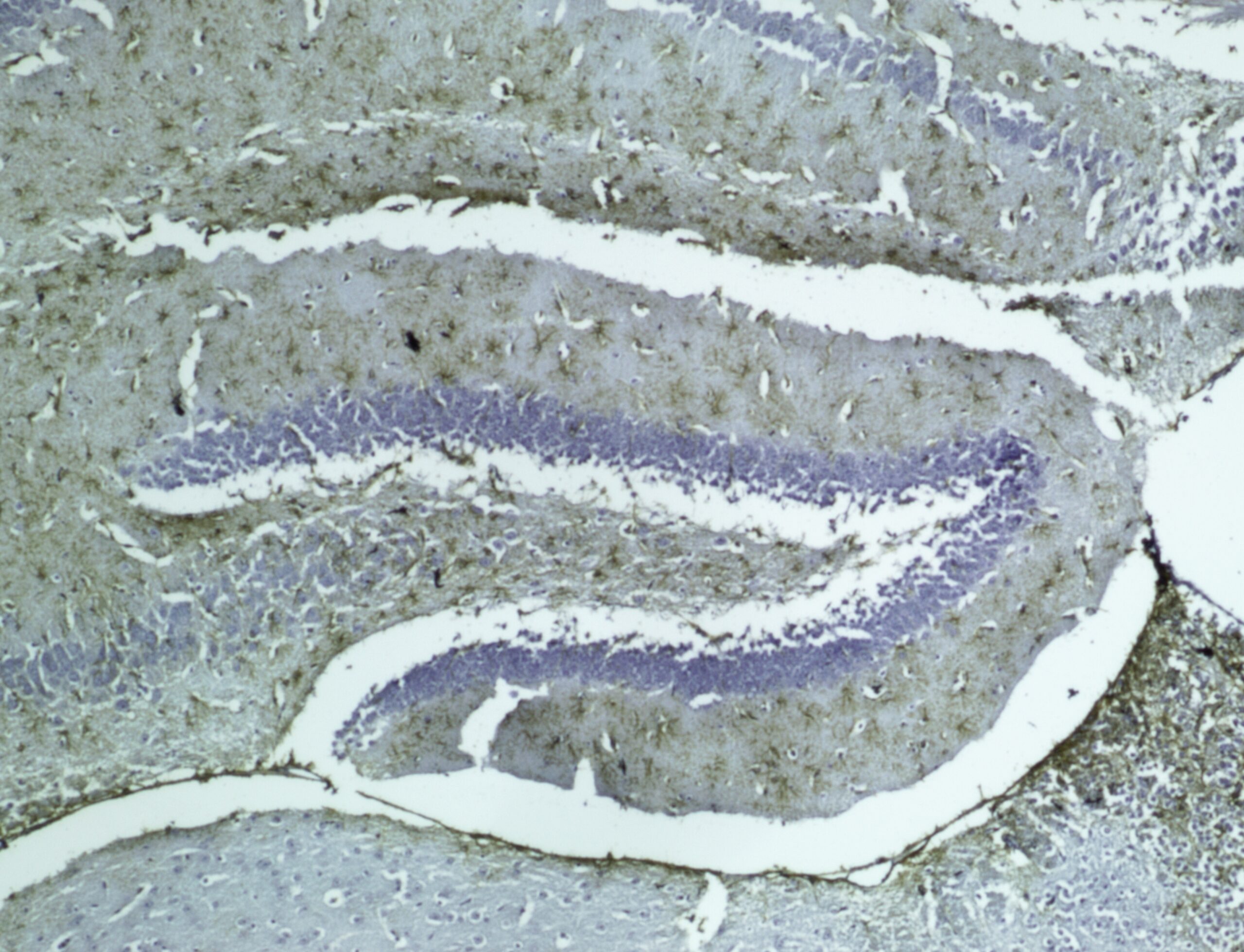 ایمونوهیستوشیمی
