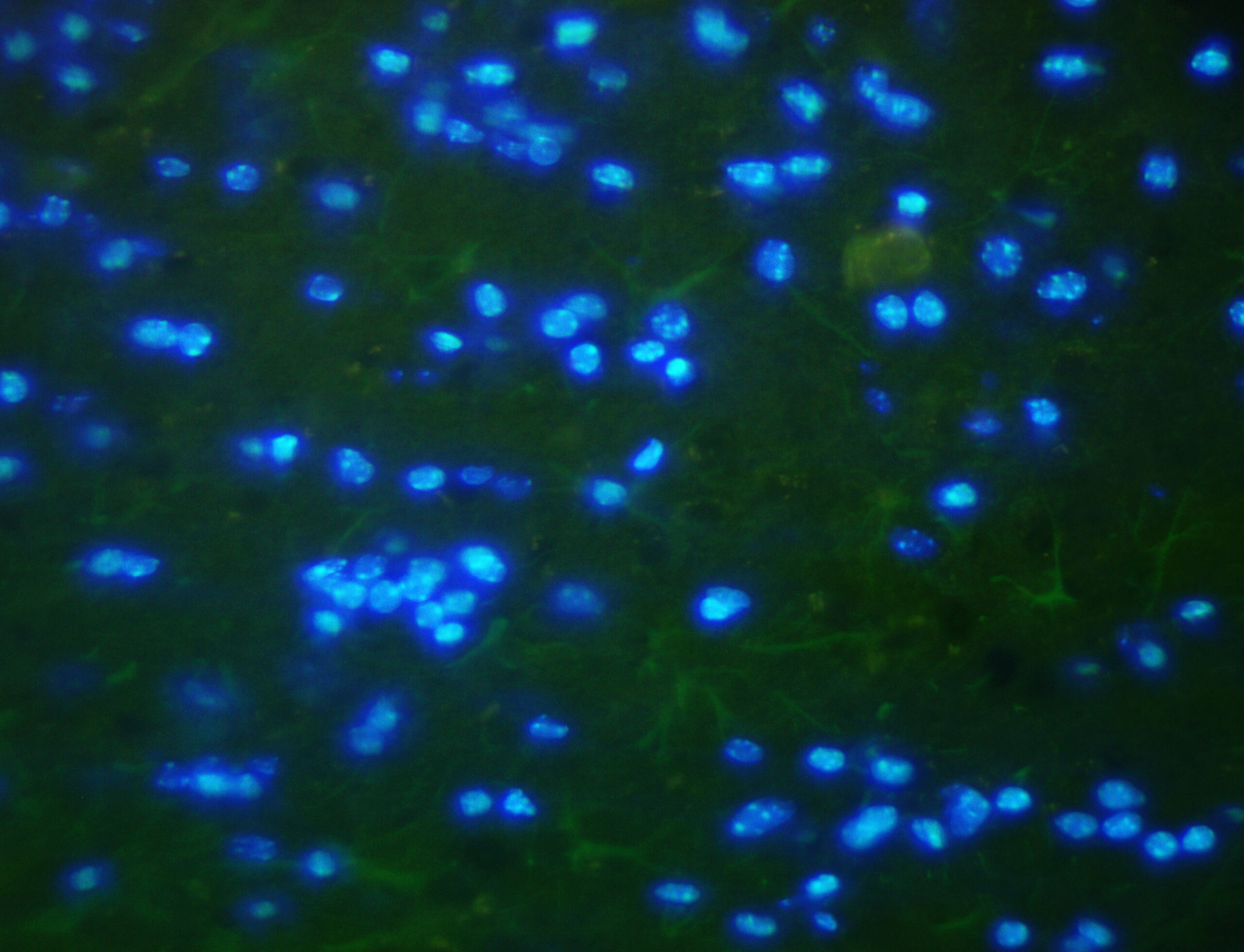 ایمونوفلورسنت