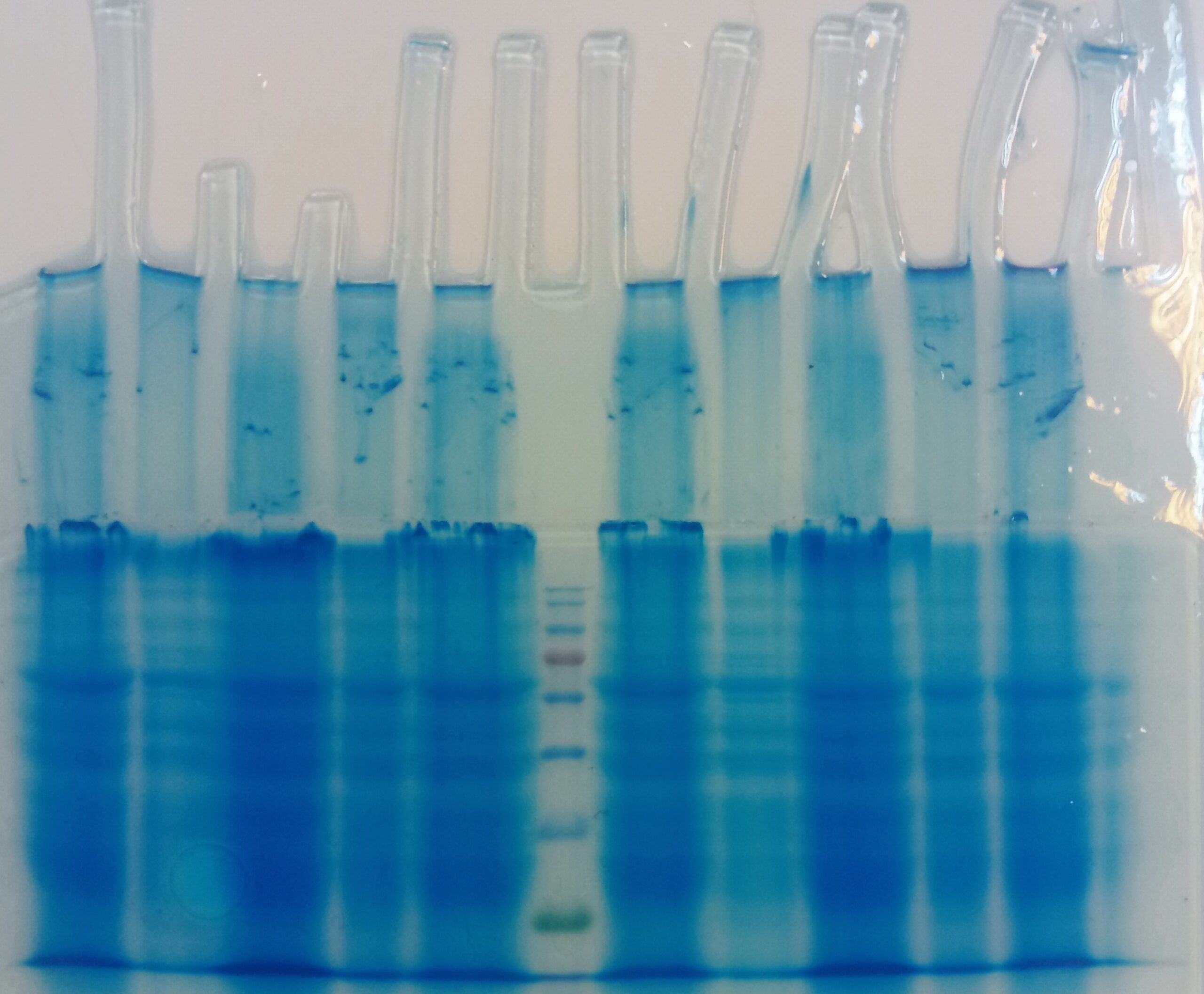 پروتئین های کلیه موش در ورک شاپ آموزشی SDS-PAGE