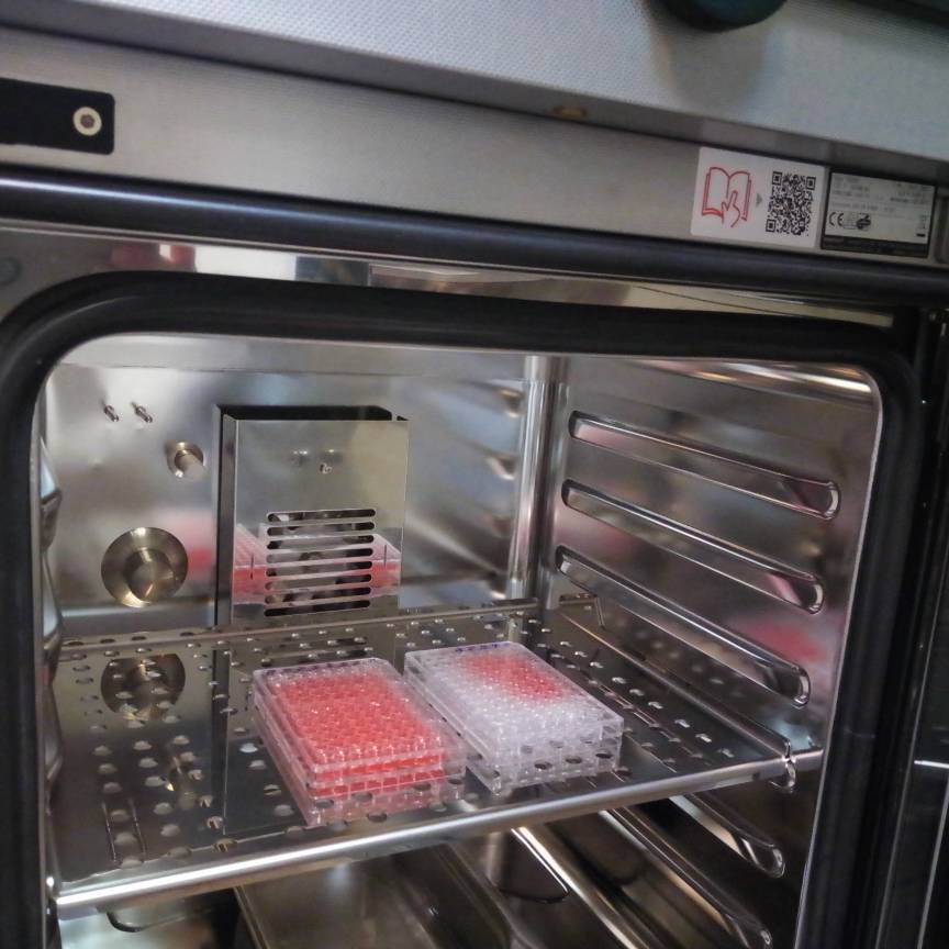 کشت اسپلنوسیت های طحال موش